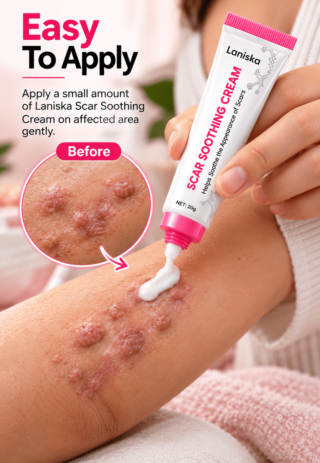 Scar Soothing Cream For Surgical Scars & Skin Repair